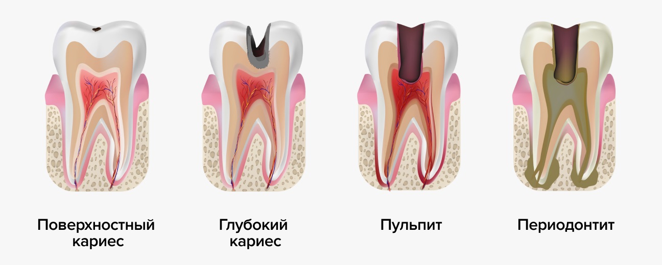 лечение болезней зубов